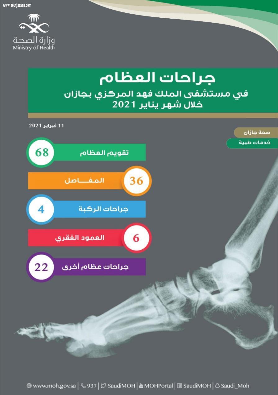 إجراء  عمليات عظام دقيقة بمستشفى الملك فهد المركزي بجازان