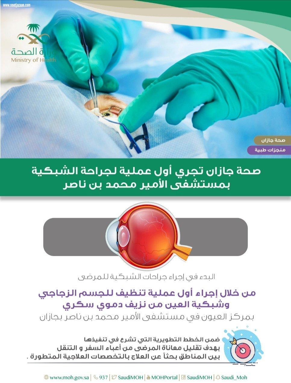 بدء إجراء جراحات الشبكية بمستشفى الأمير محمد بن ناصر في جازان