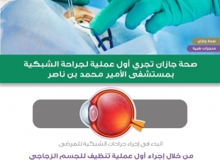 بدء إجراء جراحات الشبكية بمستشفى الأمير محمد بن ناصر في جازان